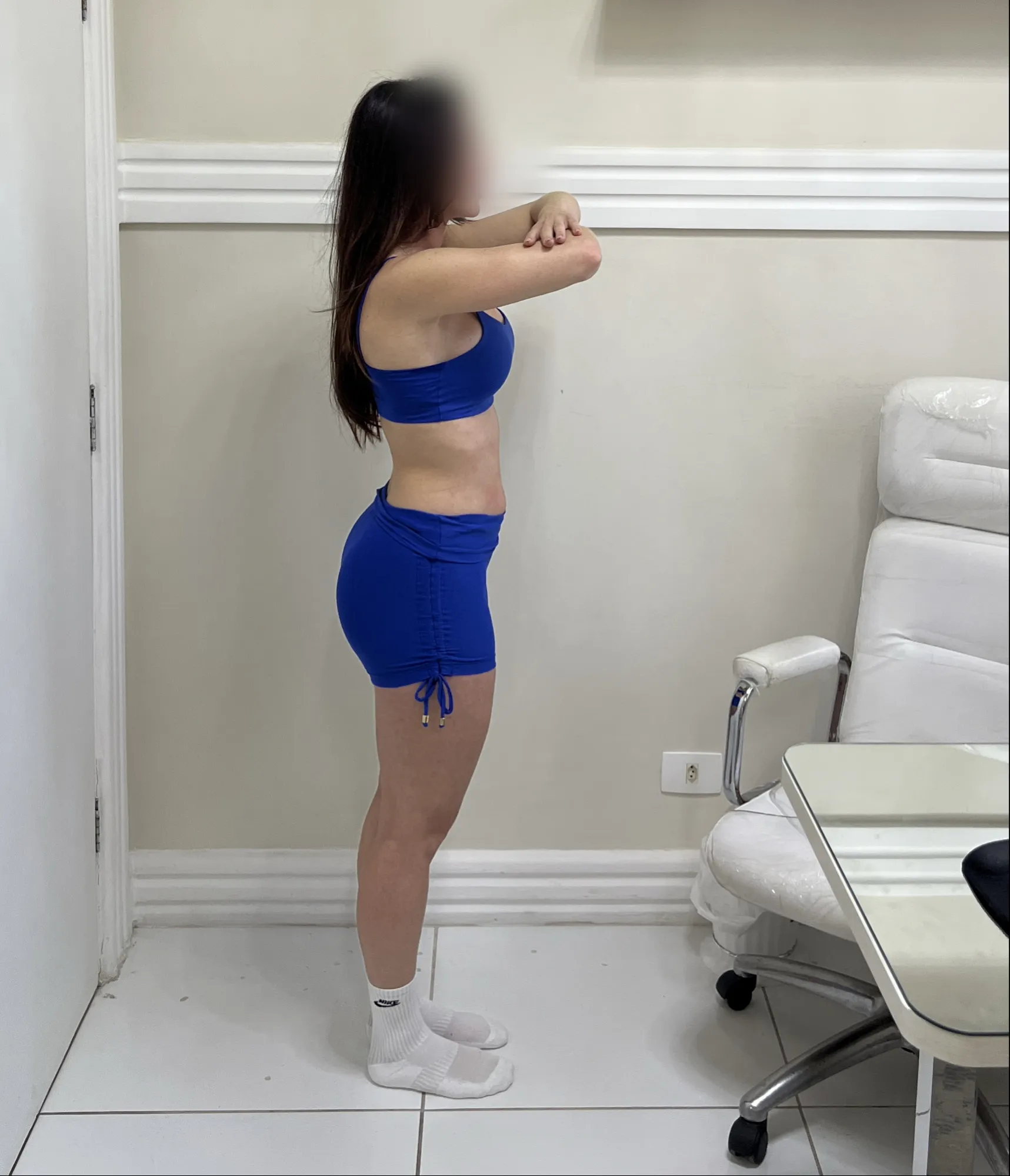 Recomposição — Lado — depois