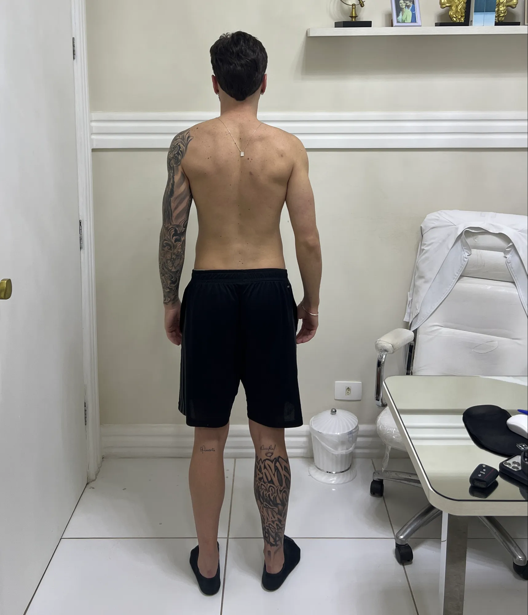 Guilherme Duarte — Frontal Contraído — depois